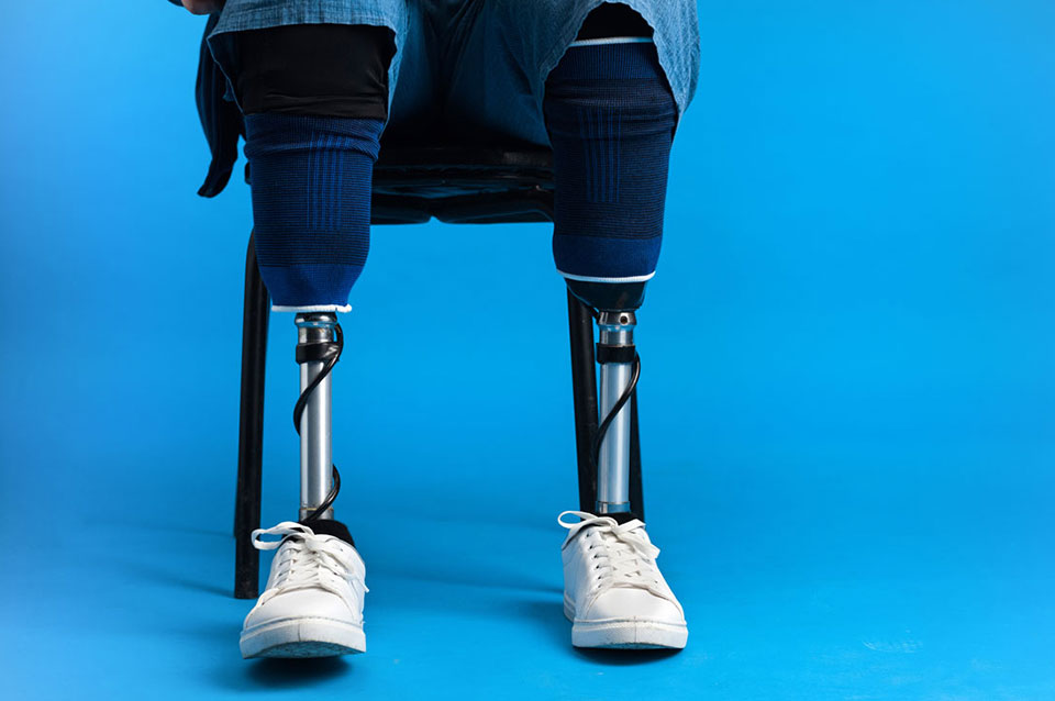Top NDIS Services You Didn’t Know You Could Access